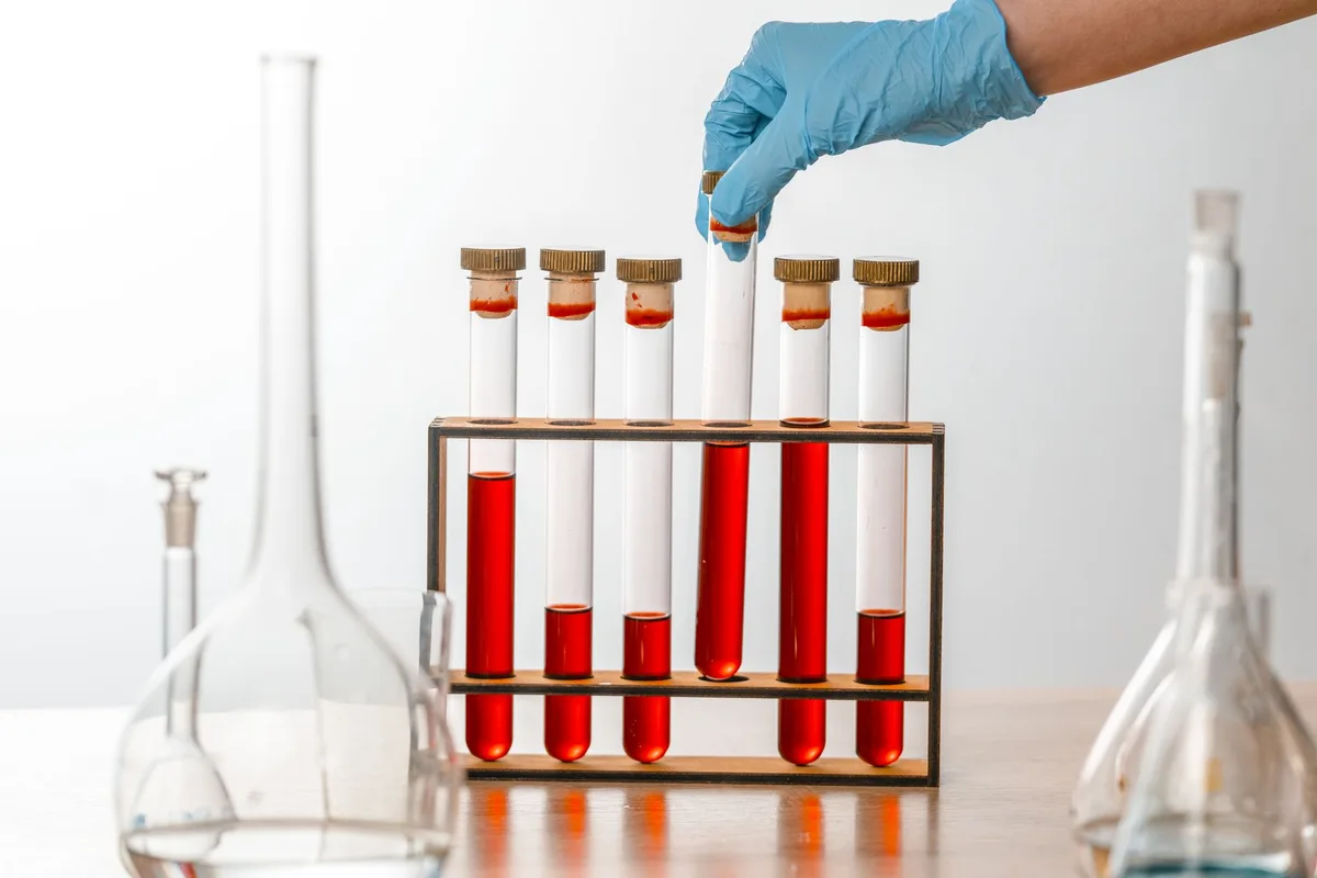 Contrôle qualité en laboratoire avec équipements de test microbiologique