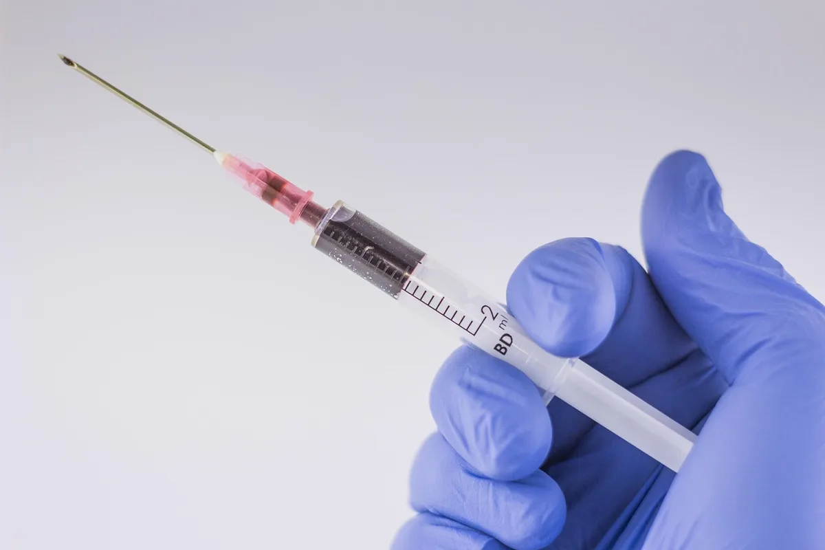 Bandelette urinaire tenue près d'un pot d'échantillon en laboratoire vétérinaire